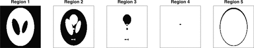Figure 4 Phantom image: each of the five different regions used in the simulations are indicated.