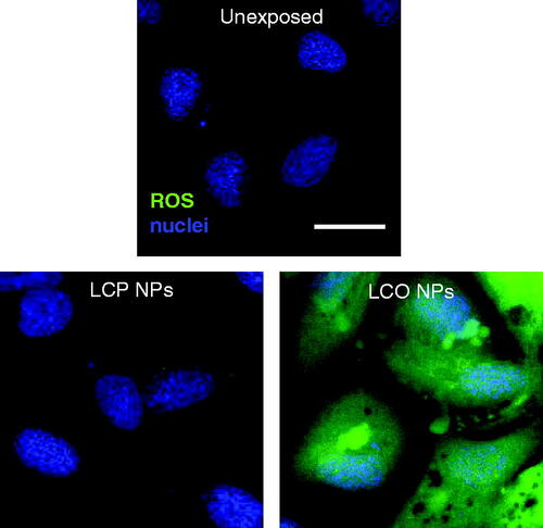 Figure 6. Gill cells were stained with Hoechst (nuclei, blue) and CM-H2DCFDA (ROS, green) to determine relative intracellular levels of reactive oxygen species (ROS) after a 3 h exposure to either 0 µg/mL (unexposed), 100 µg/mL LCP-NPs, or 100 µg/mL LCO-NPs. LCP, lithiated cobalt hydroxyphosphate; LCO, lithium cobalt oxide. Scale bar is 20 µm.