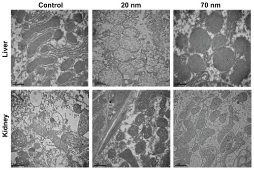 Figure 5 TEM images of the liver and kidney collected 24 hours after oral administration with two different-sized ZnO nanoparticles.