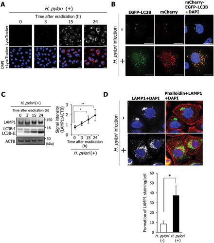 Figure 1. LAMP1 expression is induced during autolysosome formation. (a) AGS cells were incubated with a medium containing antibiotic for the indicated time period, infected with H. pylori for 5 h at a multiplicity of infection value of 50 (MOI 50), and stained with LysoTracker Red DND-99. Nuclei (blue) were stained with 4ʹ,6-diamidino-2-phenylindole (DAPI). Scale bar: 20 μm. (b) AGS cells were transfected with pTet-On and TRE2hyg-mCherry-EGFP-LC3B plasmids, infected with H. pylori for 5 h (MOI 50), and incubated in a medium containing antibiotic for 24 h. Then, EGFP and mCherry signals were detected. Nuclei (blue) were stained with DAPI. Scale bar: 20 μm. (C) LAMP1 levels were determined in AGS cells that were incubated with a medium containing antibiotic for the indicated duration after H. pylori infection for 5 h (MOI 50). Data are presented as the mean ± SD of 3 independent assays. *P < 0.05, **P < 0.01. (D) AGS cells were infected with H. pylori for 5 h (MOI 50) and incubated in a medium containing antibiotic for 24 h. Then, staining for LAMP1 and phalloidin staining were performed. Nuclei (blue) were stained with DAPI. Scale bar: 20 μm. The number of LAMP1-staining puncta were counted by using the ImageJ program. Data are presented as the mean ± SD of 3 independent images. *P < 0.05.