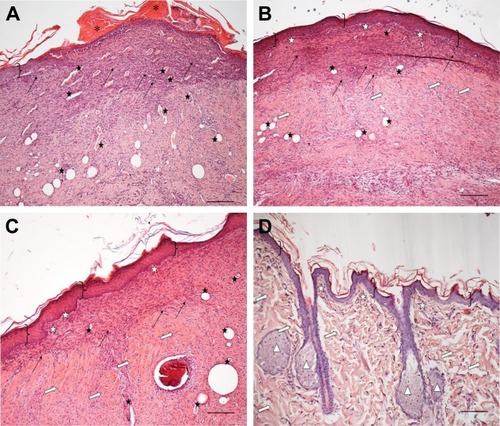 Figure 8 Microphotographs of skin sections stained with hematoxylin and eosin, taken from the wounded area at 18th day of treatment with saline solution, as negative control (A), nanostructured lipid carriers (NLC) o/e suspension (B), and NLC o/e suspension containing 5% w/w pullulan (C) in comparison with intact skin (D) (scale bar: 200 µm).Notes: Asterisk: necrotic tissue; arrow: granulation tissue; black star: vacuoles/blood vessels; white star: dermal papillae; white arrow: bundles of collagen; white triangle: dermal appendages.Abbreviations: NLC, nanostructured lipid carriers; e, eucalyptus oil; o, olive oil.