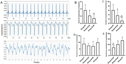 Figure 4 Effects of CFs-Exo and Sev-CFs-Exo on reperfusion arrhythmia. (A) Typical electrograms were obtained from spontaneously beating hearts during reperfusion for 30 minutes: normal electrocardiogram (top), ventricular tachycardia (middle) and ventricular fibrillation (bottom). The score basing on the Lambeth conventions (B) and duration (C) of reperfusion arrhythmia. The time for restoration of heartbeats at the point of balanced perfusion (D) and reperfusion (E). *vs group IR, #vs group N+IR. Data from n = 8 hearts. **P<0.01, ***P<0.001.