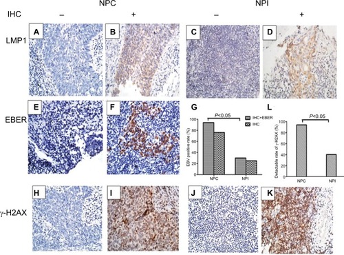 Figure 1 LMP1, EBER, and γ-H2AX expression in the clinical samples of NPC and NPI.Notes: (A–F) Representative IHC results for LMP1 (A: negative; B: positive) in human NPC samples or (C: negative; D: positive) in human NPI samples. Representative in situ hybridization results for EBER (E: negative; F: positive) in human NPC samples. (G) EBV-positive rate detection by IHC and in situ hybridization in NPC and NPI samples. (H–K) Representative IHC results for γ-H2AX (H: negative; I: positive) in human NPC samples or (J: negative; K: positive) in human NPI samples. (L) Percentage of γ-H2AX-positive specimens in NPC and NPI samples. Magnification 400×.Abbreviations: EBER, EBV encoded RNA; EBV, Epstein–Barr virus; IHC, immunohistochemistry; NPC, nasopharyngeal carcinoma; NPI, nasopharyngeal inflammation.