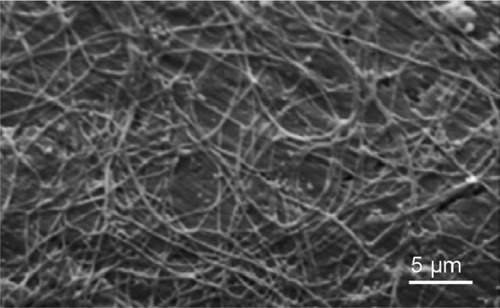 Figure 9 Scanning electron microscopy image of collagen fibrils–hydroxyapatite nanocrystals hybrid coating after decalcification in a 10-wt% EDTA solution for 24 h. Scale bar is 5 μm.