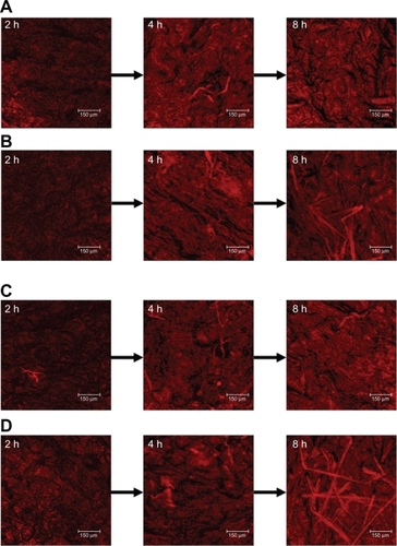 Figure 4 Confocal laser scanning microscopic (CLSM) micrographs of nude mouse skin after the in vivo topical administration of 5-aminolevulinic acid (ALA) for 2, 4, and 8 hours (left image to right image) from the aqueous control (double-distilled water) (A), ALA from oil-in-water (O/W) soybean oil emulsions (W1) (B), methyl (m)ALA from the aqueous control (double-distilled water) (C), and mALA from O/W soybean oil emulsions (W1) (D).
