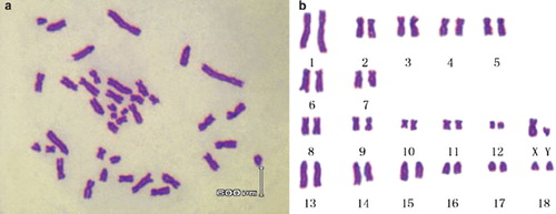 Figure 3. (a) Chromosomes of Landrace in the metaphase(♂); (b) Karyotype of Landrace fibroblasts(♂).