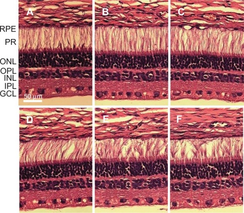 Figure 3 HE staining of structure changes in retinas at 2 weeks after intravitreal injection.Notes: (A) Low group: intravitreal injection of 2.5 mg/0.1 mL PLGA/PLA microspheres; (B) medium group: intravitreal injection of 5 mg/0.1 mL PLGA/PLA microspheres; (C) high group: intravitreal injection of 10 mg/0.1 mL PLGA/PLA microspheres; (D) EPO group: intravitreal injection of 5 mg/0.1 mL EPO–dextran PLGA/PLA microspheres; (E) PBS group: intravitreal injection of 0.1 mL 0.01 M PBS; (F) normal group: normal retinas received no intravitreal injection. No obvious structure changes were detected in the retina in the injected groups compared with the intact eyes.Abbreviations: EPO, erythropoietin; GCL, ganglion cell layer; HE, hematoxylin and eosin; INL, inner nuclear layer; IPL, inner plexiform layer; ONL, outer nuclear layer; OPL, outer plexiform layer; PBS, phosphate-buffered saline; PLGA/PLA, poly(lactic-co-glycolic acid)/poly(lactic-acid); PR, photoreceptor; RPE, retinal pigment epithelium.