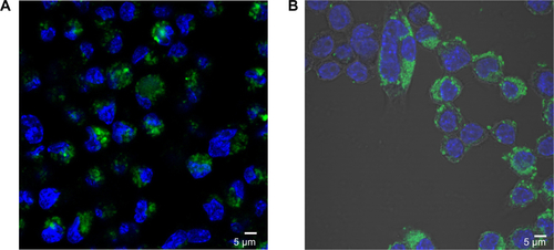 Figure S5 Quantum dot/silica and rhodamine 6G/silica particles in murine macrophages.Notes: Murine macrophage cells were grown to confluence in an eight-chamber slide and treated for 24 hours with a 100 μg/cm2 dose of (A) quantum dot/silica and (B) Rhodamine 6G/silica particles. Cells were fixed in 4% paraformaldehyde and stained with 4′,6′-diamidino-2-phenylindole (blue; cell nuclei) and E-cadherin (red; junctions between cells) and were analyzed by confocal fluorescence microscopy. Both particles are shown in green.