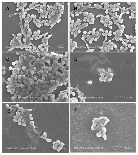 Figure 3 SEM images of the effect of AMP-17 on the morphological structure of C. albicans. (A and B) Untreated C. albicans cells are intact, with plump appearance, smooth surface, and clear cell boundaries. (C and D) C. albicans treated with AMP-17 (40 μg/mL) at 8 h showed severe irregularities in shape, and cells adhered tightly to each other; Some diseased cells ruptured and leaked out their contents (red arrowheads). (E and F) C. albicans treated with AMP-17 (40 μg/mL) at 16 h showed lysed cells and some cell debris (red arrowheads). At two time points, pseudohyphae could not be observed. The bars indicate 20 μm.