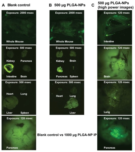 Figure 4 Distribution of poly(DL-lactide-co-glycolide) nanoparticles in vivo after intraperitoneal injection. (A) Blank control mouse. (B) Test mouse dosed with 500 μg poly(DL-lactide-co-glycolide) nanoparticles (PLGA-NPs) 30 minutes after intraperitoneal injection. (C) High-power mouse organ images. Coumarin 6-loaded poly(DL-lactideco- glycolide) nanoparticles were injected into C57BL/6 mice at 500 μg in 500 μL phosphate-buffered saline by intraperitoneal injection.Note: The mice were sacrificed 30 minutes after injection and imaged using the Olympus OV100 imaging system (Olympus Corp, Shinjuku-ku, Japan).