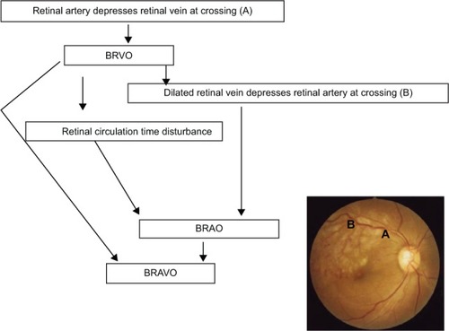 Figure 5 Suggested mechanism of BRAVO.