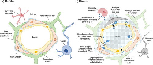 Figure 1. Schematic representation of the human blood-brain-barrier neurovascular-endothelial-unit in health (a) and disease (b) states. Increased permeability related to, for example trauma or infection, is associated with disruption of endothelial tight junctions leading to the ingress and translocation of blood-borne immune cells, and inflammatory mediators such as cytokines and microbes and their products that can activate microglia, resulting in local inflammation leading to loss of extracellular matrix and astrocyte, pericyte and neuronal cell dysfunction and death.