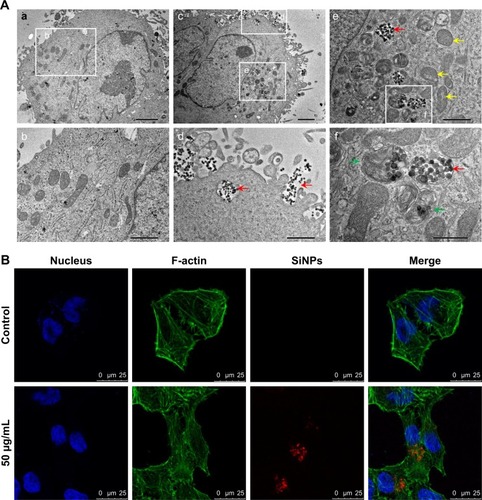 Figure 7 Subcellular localization of SiNPs in hepatic L02 cells.Notes: (A) Subcellular localization of SiNPs and ultrastructural changes in hepatic L02 cells. Control group; bar 2 µm (a). Control-group cells with intact mitochondria; bar 1 µm (b). Cells treated with SiNPs at 50 µg/mL; bar 2 µm (c). SiNPs were internalized through endocytosis by hepatic L02 cells and dispersed in membrane-bound cytoplasm (red arrows); bar 2 µm (d). SiNPs (red arrows) induced mitochondrial vacuolation, breaking, and disappearance of mitochondrial cristae (yellow arrows) in hepatic L02 cells bar 1 µm (e). Autophagolysosomes (green arrows) consisted of mitochondria and SiNPs (red arrows); bar 0.5 µm (f). (B) Cytoskeleton structure and ultrastructural observation in SiNP-treated hepatic L02 cells: F-actin (green); DAPI (blue); SiNPs (red).Abbreviation: SiNPs, silica nanoparticles.