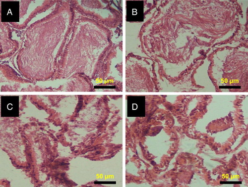 Figure 6 Histopathology of epididymis from control and 2,5-HD-treated rats. Representative photomicrographs of epididymis from control (A) and 0.25% 2,5-HD (B) showed normal morphology. Epididymis from 0.5% 2,5-HD (C) and 1% 2,5-HD (D) groups showed progressive degeneration of epididymis characterized with severe erosion of the epididymal lining and reduced epithelia layer integrity.