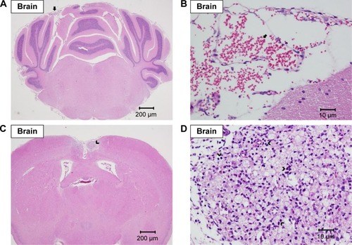 Figure 7 Histopathological analysis of brain.Note: Histopathological analysis with H&E staining of brain showing focal hemorrhage in the cortex of cerebellum (arrow) at (A) 20× and (B) 400× magnifications and focal granuloma in the cortex of the cerebrum (arrow head) at (C) 20× and (D) 400× magnifications.