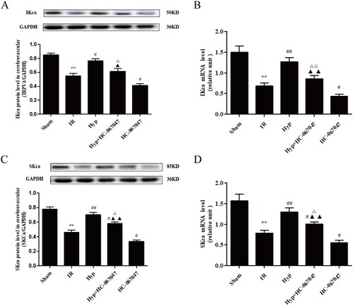 Figure 6. Effect of the TRVP4 antagonist on the expression of IKCa and SKCa. The protein and mRNA expression levels of IKCa (A, B) and SKCa (C, D) in the CBA of each rat group were detected by western blot and qPCR assays (n = 3). **p < 0.01 vs. Sham; #p < 0.05, ##p < 0.01 vs. IR; &p < 0.05, &&p < 0.01 vs. Hyp; $p < 0.05, $$p < 0.01 vs. HC-067047.
