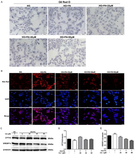 Figure 2. Effect of CA on lipid accumulation and fatty acid metabolism-related proteins in HK2 cells induced by high glucose and high lipid. (A) The lipid droplets (black lens) of HK2 cells treated with 20, 40, 80 μM CA for 24 h were detected by oil red O staining under high glucose and high lipid conditions; (B) The lipid droplets of HK2 cells treated with 20, 40, 80 μM CA for 24 h were detected by Nile red staining under high glucose and high lipid conditions; (C–E) the expression levels of lipid metabolization-related proteins (CPT1A and SREBP1c) in HK2 cells treated with 20, 40, 80 μM CA for 24 h were detected and quantified by Western blot method under high glucose and high lipid conditions. Data are presented as means ± SEM; #p < 0.05, ###p < 0.001 vs. NG group; **p < 0.01, ***p < 0.001 vs. HG + PA group, n = 3.