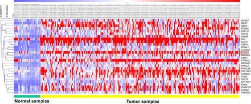 Figure S1 Cluster miR-429 targets expression profile between normal tissues and gastric tumors.Notes: Statistical analysis of the miR-429 targets between 33 normal samples and 249 gastric tumor samples predicts 168 differently expressed genes. The color scale denotes the extent of relative upregulation (red) and downregulation (blue). Green and yellow column-wise color codes for 33 normal and 249 tumor samples, respectively. Y-axis displays the gene symbol and the gene fascin-1 (FSCN1) is marked within the red rectangle.