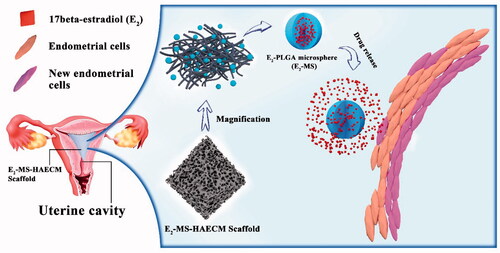 Figure 1. Schematic diagram of E2-MS-HAECM scaffold as the intrauterine controlled release system for endometrium regeneration.