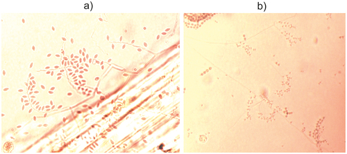 Figure 12. Engyodontium album in hemp shives samples.