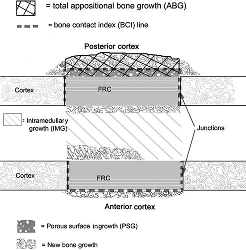 Figure 6. Schematic model showing the different areas included in the histometrical measurements.