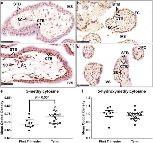 Figure 2. Immunohistochemical labelling of 5-methylcytosine (5-mC) and 5-hydroxymethylcytosine (5-hmC) in first trimester and term tissue sections. (a) & (b). Representative images of 5-mC labelling in a first-trimester section and term tissue section, respectively. (c) & (d). Representative images of 5-hmC labelling in a first-trimester section and term tissue section, respectively. (e). Video image analysis (VIA) quantification of staining intensity revealed an increase in levels of 5-mC in tissue sections from term placenta (n = 17) compared to first trimester (n = 10). (f). There was no difference in the staining intensity of 5-hmC between first trimester (n = 10) and term tissue (n = 17) sections. Data are median and interquartile range. Significance was determined using a Mann-Whitney test. CTB: cytotrophoblast, FC: fetal capillary, IVS: intervillous space, SC: stromal cell, STB: syncytiotrophoblast.