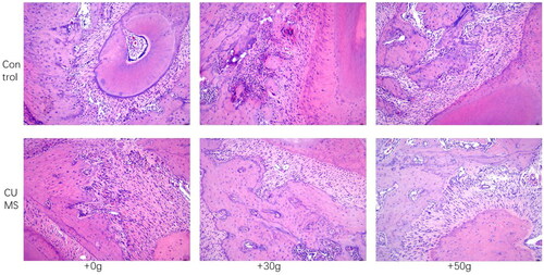 Figure 3. HE staining showed that the alveolar bone fibers in the tooth movement area in the CUMS group were sparse and osteoclast lacuna was substantially increased.