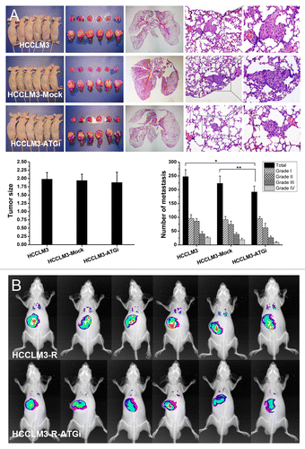 Figure 2. In vivo analysis of the effect of autophagy inhibition on HCC metastasis. (A) Nude mouse model of pulmonary metastasis was established using HCC cells with or without autophagy inhibition (HCCLM3-ATGi or HCCLM3/HCCLM3-Mock). Histopathological analysis showed that there were significantly fewer lung metastases of mice receiving HCCLM3-ATGi cells than in mice subjected to HCCLM3 and HCCLM3-Mock cells. *P = 0.001, **P = 0.044. (From left to right) Mice receiving orthotopic implantation of HCCLM3 / HCCLM3-ATGi / HCCLM3-Mock cells, lung and liver of the mice, representative panoramic image of lung section, lung metastasis (100×) and lung metastasis (200×); (B) Small-animal imaging analysis using RFP-expressing HCCLM3-R-ATGi and HCCLM3-R cells confirmed the histopathological analysis. The images of fluorescence signals were pseudocolored (pink, least intense; red, most intense), and the images of lung metastases and primary HCC tumors were merged onto the corresponding X-ray images.