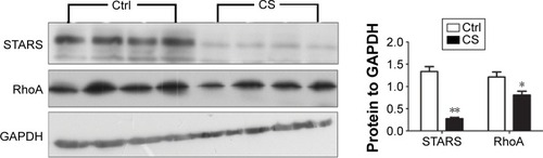 Figure 4 The expression of STARS and RhoA protein in CS-exposed and control mice.