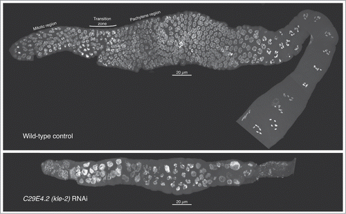 Figure 3. Meiotic progression and nuclear morphology are aberrant in kle-2—depleted germlines. Gonads were dissected from wild type (top) or kle-2—depleted young adults, fixed, and DAPI stained. In each image, the distal tip of the gonad is on the left; nuclei proceed through meiosis and gametogenesis as they travel down the gonad. In the wild-type control, mitotic nuclei can be seen near the distal tip. The transition zone, characterized by asymmetrical chromatin within nuclei, marks the entry into meiosis. Adjacent to the transition zone, pachytene nuclei with paired chromosomes can be seen, with numerous diakinesis nuclei evident at the proximal end of the gonad (lower right). After kle-2 RNAi (bottom), the gonad architecture is dramatically altered: the overall number of nuclei is greatly reduced, suggesting germline proliferation defects. Most nuclei in the mitotic zone appear enlarged with punctate DNA staining, suggestive of chromosome fragmentation. Mitotic figures are absent, suggesting cell-cycle delay or arrest. Although some nuclei have a pachytene-like appearance, the transition zone is absent and the majority of nuclei in the meiotic region appear disorganized. There appear to be no diakinesis nuclei, and mature oocytes are absent. Thus, depletion of kle-2 results in dramatic defects in gamete production and fertility.