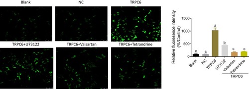 Figure 3 Tetrandrine inhibits TRPC6 overexpression-induced intracellular Ca2+ influx in MPC5 podocytes. Fluorescence image of fluo-3AM loaded cells (green) indicates intracellular Ca2+ influx. Differences were analyzed using one-way ANOVA. Significant differences with p < 0.05 are indicated by different letters. NC: containing blank lentivirus vector. blank:normal MPC5 podocyte. TRPC6 group: TRPC6-overexpressing.