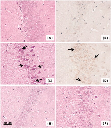 Figure 4. Histopathological examination of brain (hippocampus): (A) Haematoxylin/eosin (HE) stained specimen of the control group, (B) 8-hydroxy-2′-deoxyguanosine (8-OHdG) stained specimen of the control group, (C) HE stained specimen of the carbon monoxide (CO) poisoning group, (D) 8-OHdG stained specimen of the CO poisoning group, (E) HE stained specimen of the CO-bound haemoglobin vesicles (CO-HbV) 50 group, and (F) HE stained specimen of the CO-HbV25 group. Arrows indicate some representative necrotic cells.