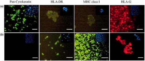 Figure 4. Immunofluorescence staining of fresh AECs (a) and control groups (b). (a) AECs staining with specific antibodies conjugated with FITC (green) and phycoerythrin (red), (b) Representative image of negative and positive controls; from the left: negative control in all immunocytochemical experiments in which the primary antibody was deleted; macrophage (MQ) cells as positive control for HLA-DR; macrophage (MQ) cells as positive control for HLA class I; and choriocarcinoma (JEG-3) cell line as positive control for HLA-G antibody, respectively. Inset shows nuclear staining by DAPI for the same images. (Scale bar = 100 µm).
