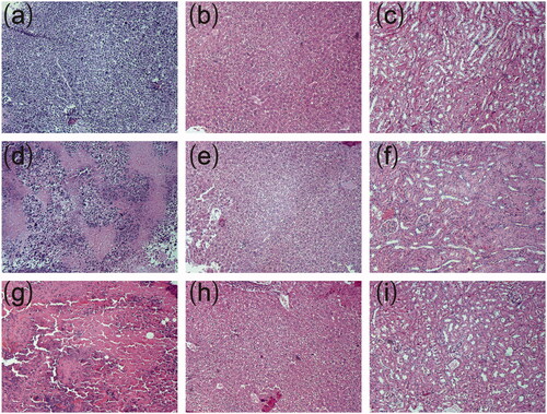 Figure 4. Typical histopathological images of tumors and major organs of sarcoma 180 tumor-bearing mice (magnification ×100). (a) Histopathological image of tumor without treatment, (b) Histopathological image of liver without treatment, (c) Histopathological image of kidney without treatment, (d) Histopathological image of tumor treated with low-dose cisplatin-loaded implants, (e) Histopathological image of liver treated with low-dose cisplatin-loaded implants, (f) Histopathological image of kidney treated with low-dose cisplatin-loaded implants, (g) Histopathological image of tumor treated with high-dose cisplatin-loaded implants, (h) Histopathological image of liver treated with high-dose cisplatin-loaded implants, (i) Histopathological image of kidney treated with high-dose cisplatin-loaded implants.