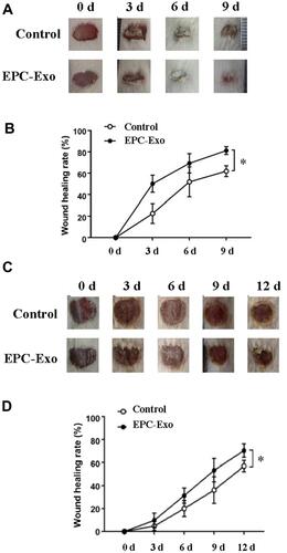 Figure 2 EPC-derived exosomes promote skin wound healing in normal and diabetic mice. Wound area changes (A) and wound healing rate (B) with treatment of EPC-derived exosomes (EPC-Exo) or with PBS (control) for 9 days in normal mice. Values represent the mean ± SE (n = 3); *P < 0.05. Wound area changes (C) and wound healing rate (D) with treatment of EPC-derived exosomes or with PBS for 12 days in diabetic mice. Values represent the mean ± SE (n = 5); *P < 0.05.