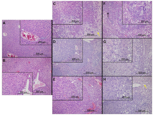 Figure 1 Liver and tumor tissue from mice with different genotypes show differing phenotypes on histological examination.