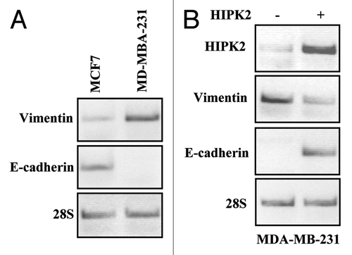 Figure 1. mRNA expression of vimentin and E-cadherin in breast cancer cells after HIPK2 overexpression. (A) Semi-quantitative RT-PCR analysis of vimentin and E-cadherin in MCF7 and MDA-MB-231 cells. 28S mRNA levels were detected as control of cDNA inputs. (B) MDA-MB-231 cells were transfected with HIPK2 expression vector and vimentin and E-cadherin mRNA levels were detected 24 h after transfection. HIPK2 mRNA levels are indicative of HIPK2 overexpression. 28S mRNA levels were detected as control of cDNA inputs.