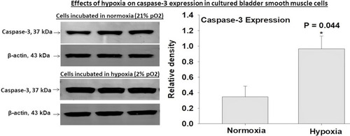 Figure 5 Incubation of human bladder smooth muscle cells under the hypoxic condition at 2% pO2 caused a significant increase in caspase-3 expression in comparison with cells incubated in normoxia at 21% pO2. The data suggest that hypoxia may be an essential mediating factor in caspase-3 upregulation. Increased expression levels of both caspase-3 and ASK1, shown in Figure 4, suggest potential crosstalk mechanisms between the two molecules under the hypoxic conditions. * represents significant change in the hypoxic smooth muscle cells versus cells incubated in normoxia.