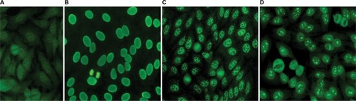 Figure 1 Representative photomicrographs of antinuclear antibody (ANA) patterns at 400× magnification. (A) negative ANA; (B) positive/homogeneous pattern; (C) positive/speckled pattern; (D) positive/nucleolar pattern.
