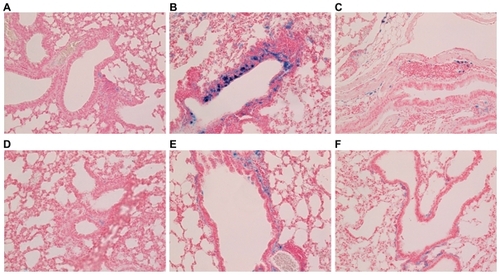 Figure 4 Prussian-blue staining of lung parenchyma around the airway (magnification ×200). (A), (B), (C): 30 minutes, 3, and 48 hours, respectively, after intraperitoneal (IP) injection of ultrasmall superparamagnetic iron oxide. (D), (E), (F): 30 minutes, 3, and 48 hours, respectively, after IP injection of small superparamagnetic iron oxide.