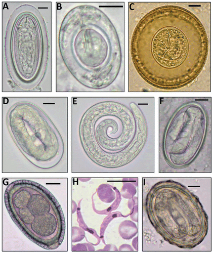 Figure 3: Helminth eggs and larva & the protozoan blood parasite found (scale bars = 10 μm). A: M. moniliformis egg; B: H. nana egg; C: H. diminuta egg; D: A. cantonensis egg; E: A. cantonensis L1 larva; F: Gongylonema sp. egg; G: C. hepaticum egg; H: Trypanosoma lewisi trypomastigotes; I: Ascaris sp. egg.