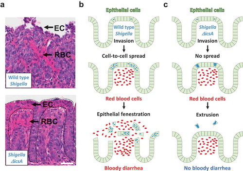 Figure 2. Connecting Cell Biology and pathogenesis. (a) Representative images of hematoxylin- and eosin-stained colonic mucosa of infant rabbit colon infected with wild type S. flexneri (top) and the ΔicsA mutant (bottom). EC, epithelial cell; RBC red blood cell. Dotted lines delineate crypts. Scale bar, 50 μm. (b) Top. Wild type S. flexneri (blue) invades the colonic epithelium (green). Middle. Wild type bacteria spread from cell to cell. Intracellular infection leads to vascular lesions and red blood cell infiltration (red). Bottom. The combination of epithelial fenestration due to cell-to-cell spread and red blood cell infiltration leads to bloody diarrhea. (c) Top. The ΔicsA mutant (blue) invades the colonic epithelium (green). Middle. The ΔicsA mutant does not spread from cell to cell and grows as macro-colonies. Intracellular infection leads to vascular lesions and red blood cell infiltration (red). Bottom. In absence of cell-to-cell spread, cells infected with the ΔicsA mutant are eliminated, presumably through extrusion. The epithelial structure remains intact, and the animals do not experience bloody diarrhea, or any signs of illness.