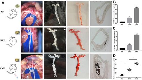 Figure 2 Effect of CML on atherosclerotic plaque formation and calcification in apoE-/- mouse. (A) 32 weeks after CML injection, oil red staining was performed. The orange-red part was atherosclerotic plaque. Plaque calcification was detected by vonkossa staining. The black part represented calcium salt deposits. (B) The concentration of CML in aortic tissue was detected by ELISA. (C) Calcium content of the aorta tissue in each group was compared. (D) Image J software measures the ratio of aortic plaque area to aortic area. *P<0.05, compared with NC group. #P<0.05, compared with HFD group.