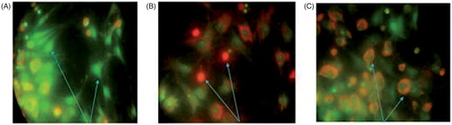Figure 4. The assessment of MCF-7 apoptosis by propidium iodide/acridine orange staining. The green cells with diffused chromatin are viable (A), the red cells with no condensed chromatin are necrotic (B) and the cells with condensed chromatin are apoptotic (C).