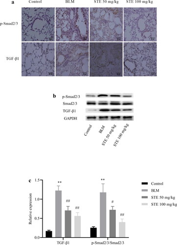 Figure 8. Effect of STE on the TGF-β1 and p-Smad2/3 pathways. (a) Immunohistochemical staining of TGF-β1 and p-Smad2/3 (400×). (b) The protein levels of TGF-β1, Smad2/3 and p-Smad2/3 were measured by Western blotting. (c) Relative density values showing TGF-β1 expression and phosphorylation of Smad2/3. n = 3 for each group. *p < 0.01 vs. control; #p < 0.05 and ##p < 0.01 vs. BLM.