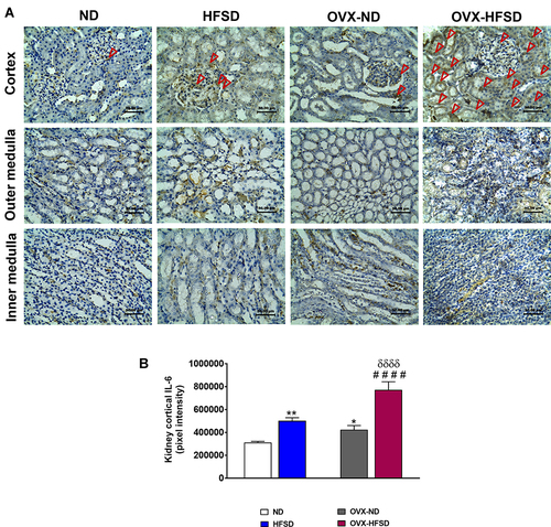 Figure 6 Immunohistochemical staining of IL-6 in kidneys in the cortex, outer medulla and inner medulla regions (A) and quantification of mean pixel intensities of kidney cortical IL-6 staining (B) of normal diet (ND)- and high fat style diet (HFSD)-fed rats, with and without ovariectomy (OVX) (n = 12 per group) at 40X magnification. Dark red arrow indicates the positive immunohistochemical stainings. *P < 0.05 or **P < 0.01 vs. ND; ####P < 0.001 vs. OVX-ND; δδδδP < 0.001 vs. HFSD.