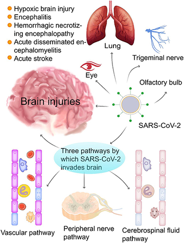 Figure 1 SARS-CoV-2 infection can cause brain damage through three possible routes. COVID-19 infection causes various brain injuries and diseases (eg, hypoxic brain injury, encephalitis, hemorrhagic necrotizing encephalopathy, acute disseminated encephalomyelitis, and acute stroke). SARS-CoV-2 invades the brain likely through three routes: (1) the vascular pathway where SARS-CoV-2 damages the blood-brain barrier to invade the brain via blood or lymphatic circulation; (2) the peripheral nerve pathway in which SARS-CoV-2 infects the olfactory bulb, the trigeminal nerve, the vagus nerve, and finally the brain through trans-neuronal or retrograde axonal transport; and (3) the cerebrospinal fluid pathway, SARS-CoV-2 can enter the brain through circulating cerebrospinal fluid to trigger a series of proinflammatory and immune responses that eventually result in various brain injuries with neuropsychiatric symptoms.