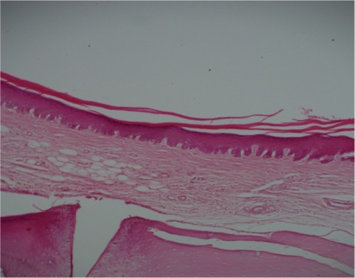 Figure 10 Control group at day 14.Note: Modest increase in fibrous tissue under the near-normal epithelial layer (hematoxylin and eosin, 100×).