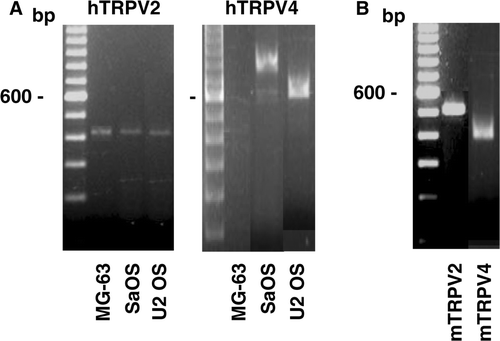 Figure 3.  Gene expression of the TRPV channels in osteoblast-like cells. Complementary DNA synthesised with total RNA isolated from human (A) or murine (B) cells was used for PCR amplifications using specific primers for human TRPV (hTRPV) or murine TRPV (mTRPV) channels. Representative data are shown from RNA isolations of at least three independent cultures. Left lane: 100 bp ladder.