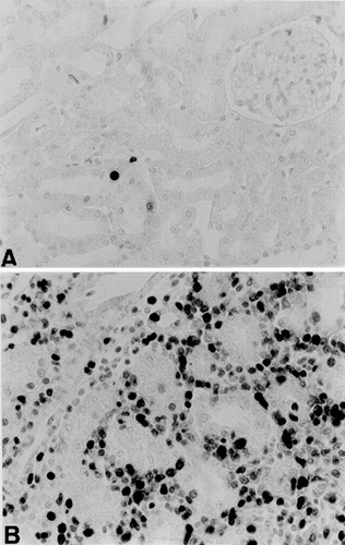 Figure 3. Immunolocalization of PCNA in the renal cortex of a rat killed on day 18 after treatment with 3.5 mg/kg adriamycin (B) and of a control rat (B). Observe that the amount of PCNA positive cells is higher in B. ×420.